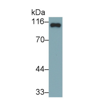 Involucrin (INV) Human Polyclonal Antibody