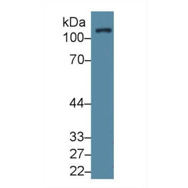 Focal Adhesion Kinase (FAK) Human Polyclonal Antibody