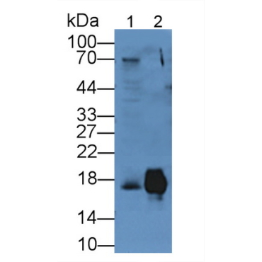 Cluster of Differentiation 59 (CD59) Human Polyclonal Antibody