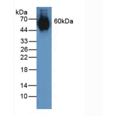 Elastin (ELN) Human Polyclonal Antibody