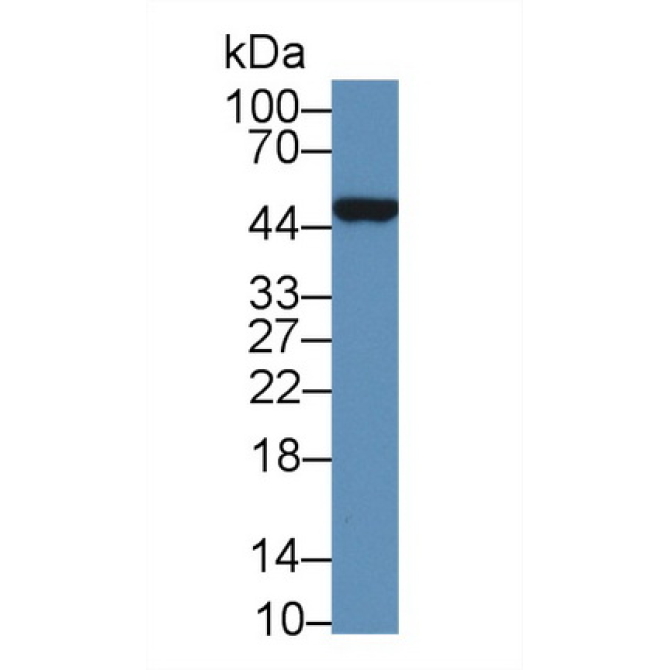 Beta Actin (ACTB) Human Polyclonal Antibody