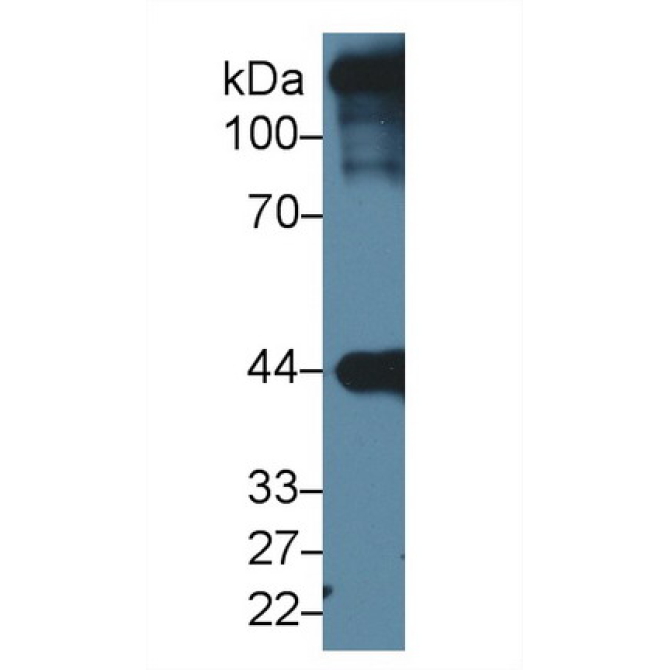 Actin Alpha 1, Cardiac Muscle (ACTC1) Human Polyclonal Antibody