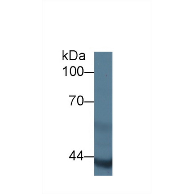 Actin Alpha 2, Smooth Muscle (ACTa2) Human Polyclonal Antibody