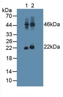 Pituitary Adenylate Cyclase Activating Peptide (PACAP) Human Polyclonal Antibody