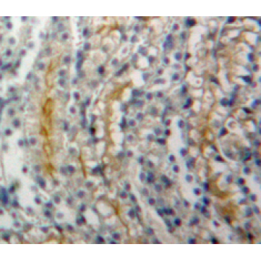 Adenylate Cyclase 1, Brain (ADCY1) Mouse Polyclonal Antibody