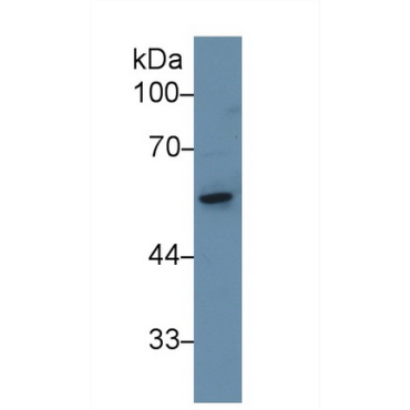 Adenylyl Cyclase Associated Protein 1 (CAP1) Human Polyclonal Antibody