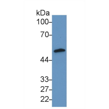 Adipose Differentiation Related Protein (ADRP) Human Polyclonal Antibody
