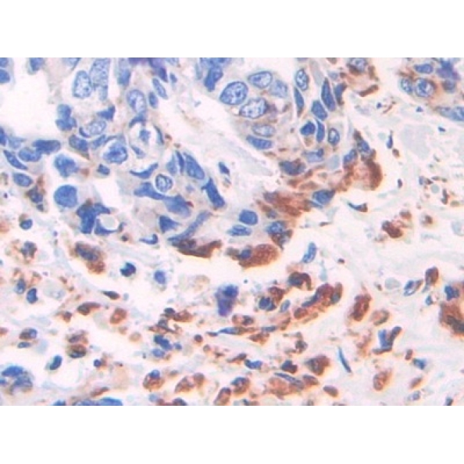 Adipose Differentiation Related Protein (ADRP) Human Polyclonal Antibody