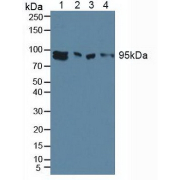 Aryl Hydrocarbon Receptor (AhR) Human Polyclonal Antibody