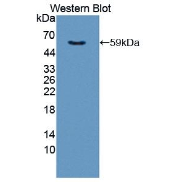 Aryl Hydrocarbon Receptor (AhR) Mouse Polyclonal Antibody