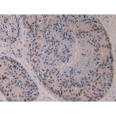 5-Lipoxygenase (5-LO) Human Polyclonal Antibody