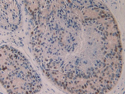 5-Lipoxygenase (5-LO) Human Polyclonal Antibody