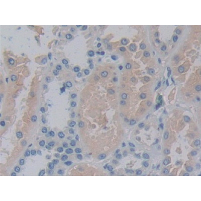 15-Lipoxygenase-2 (15-LO-2) Human Polyclonal Antibody