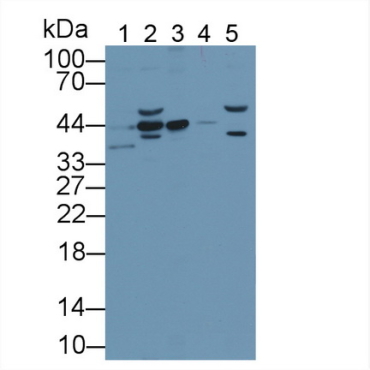 Extracellular Signal Regulated Kinase 1 (ERK1) Human Polyclonal Antibody