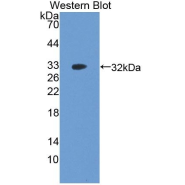 Apoptosis Signal Regulating Kinase 1 (ASK1) Human Polyclonal Antibody