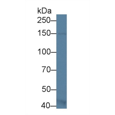 Apoptosis Signal Regulating Kinase 1 (ASK1) Mouse Polyclonal Antibody