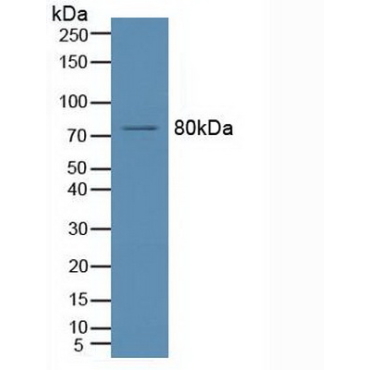 Acid Sphingomyelinase (ASM) Human Polyclonal Antibody