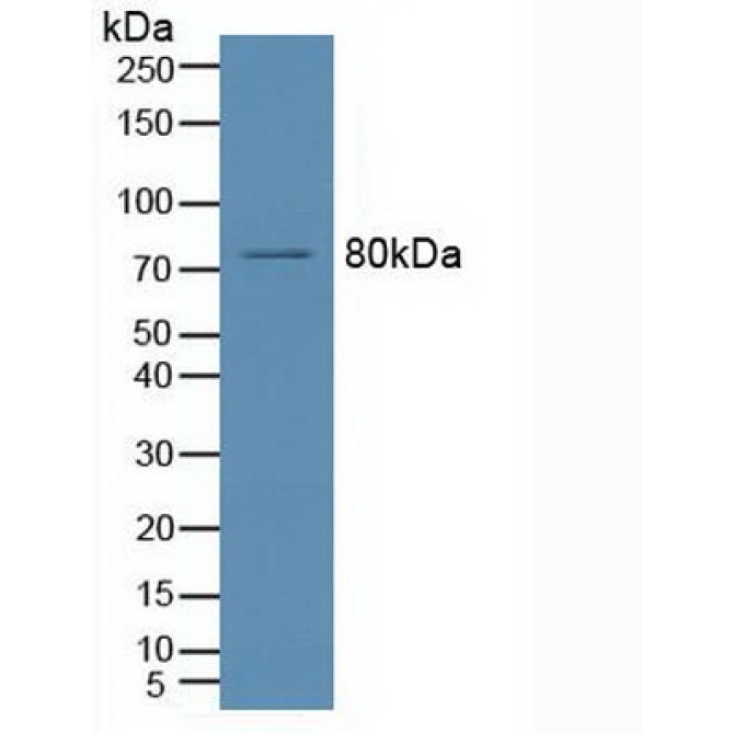 Acid Sphingomyelinase (ASM) Human Polyclonal Antibody