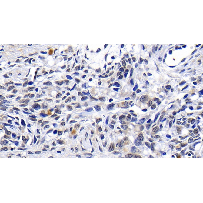 Ataxia Telangiectasia Mutated (ATM) Human Polyclonal Antibody