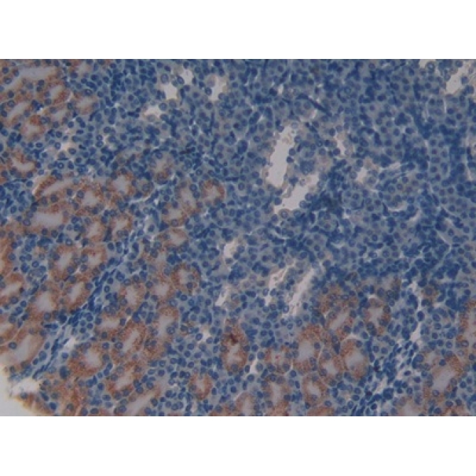 Ataxia Telangiectasia Mutated (ATM) Mouse Polyclonal Antibody