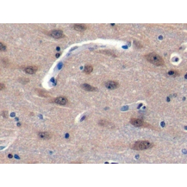 Protocadherin 1 (PCDH1) Human Polyclonal Antibody