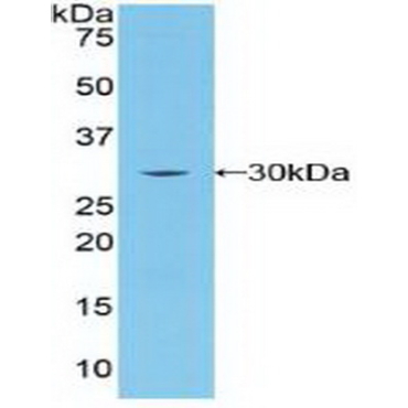 Breast Cancer Susceptibility Protein 2 (BRCA2) Human Polyclonal Antibody