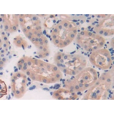 Breast Cancer Susceptibility Protein 2 (BRCA2) Mouse Polyclonal Antibody