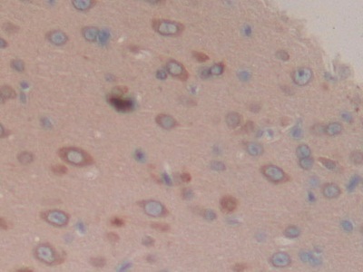 Breast Cancer Susceptibility Protein 2 (BRCA2) Rat Polyclonal Antibody