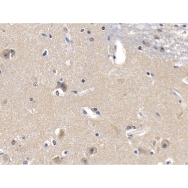 Glucokinase Regulatory Protein (GKRP) Human Polyclonal Antibody
