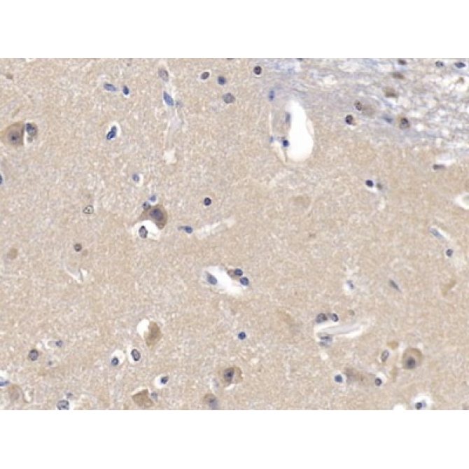 Glucokinase Regulatory Protein (GKRP) Human Polyclonal Antibody