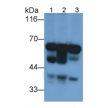 Glucokinase Regulatory Protein (GKRP) Mouse Polyclonal Antibody