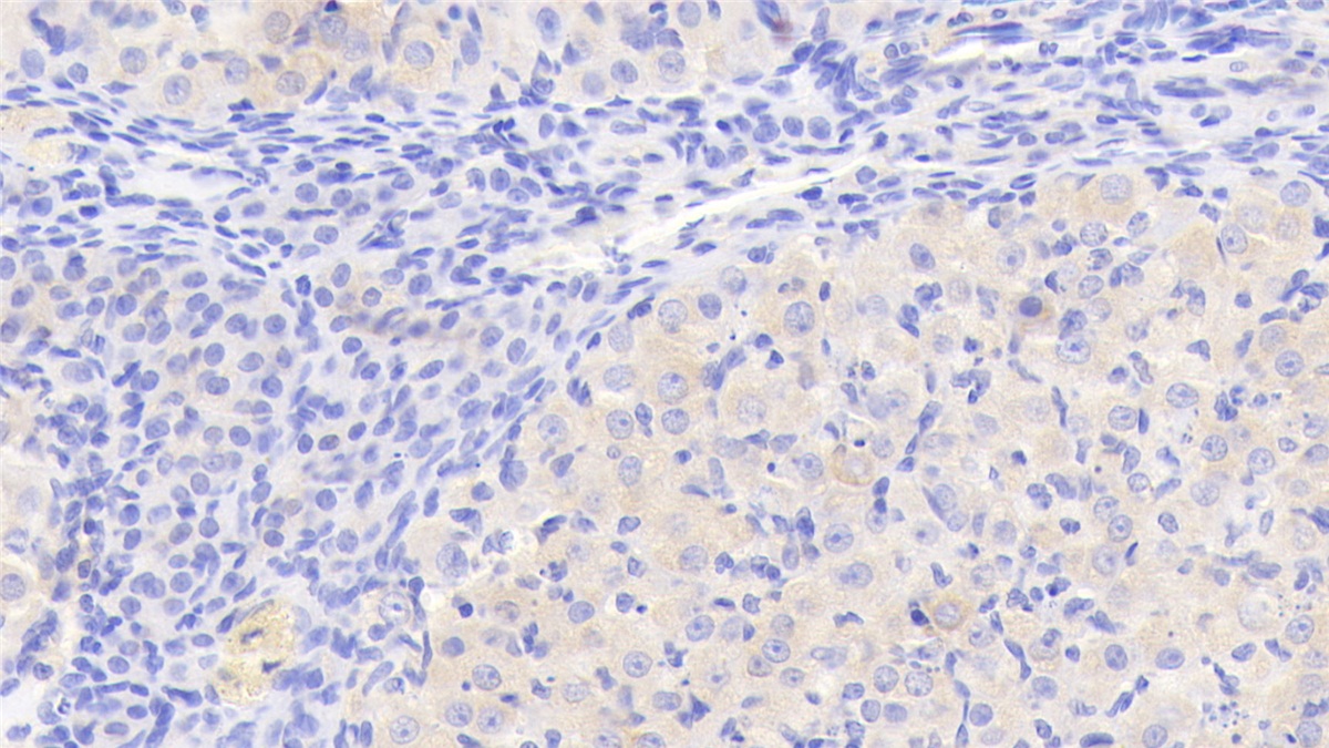 Glucokinase Regulatory Protein (GKRP) Rat Polyclonal Antibody