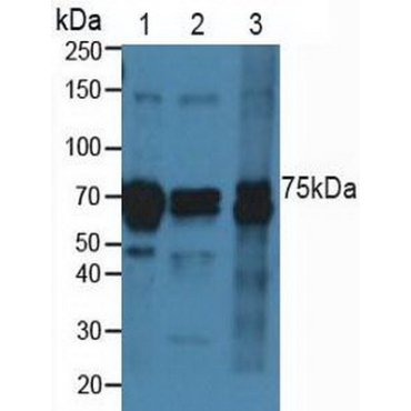 Cadherin 5 (CDH5) Human Polyclonal Antibody