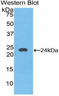 Cadherin 5 (CDH5) Mouse Polyclonal Antibody