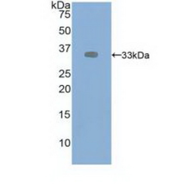 Vascular Endothelial Growth Factor Receptor 2 (VEGFR2) Human Polyclonal Antibody
