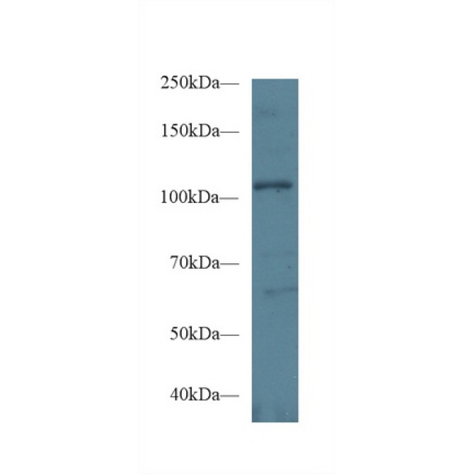 Ephrin Type A Receptor 1 (EPHA1) Mouse Polyclonal Antibody