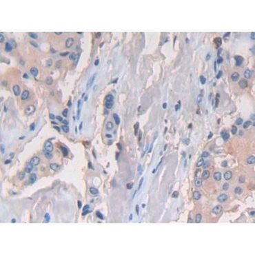 Cluster Of Differentiation 74 (CD74) Human Polyclonal Antibody