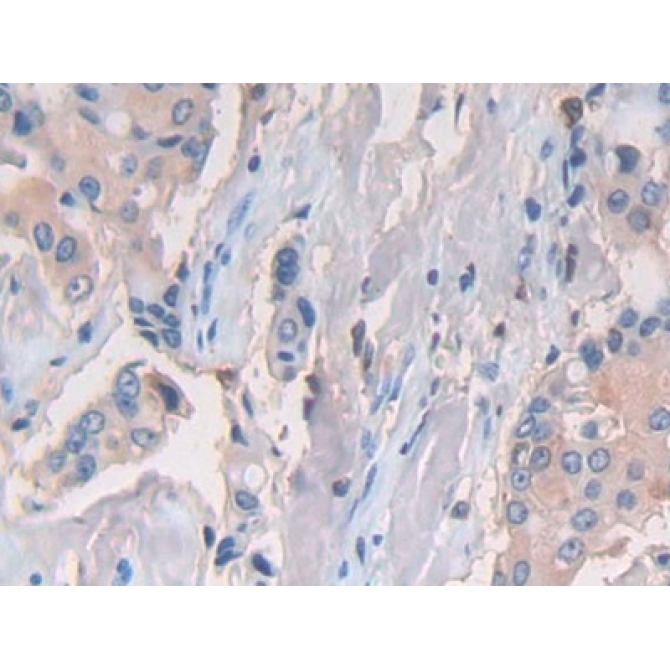Cluster Of Differentiation 74 (CD74) Human Polyclonal Antibody