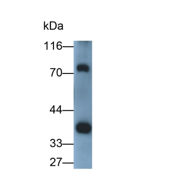 Lactate Dehydrogenase A (LDHA) Human Polyclonal Antibody