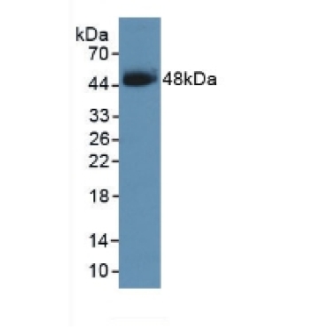 Serpin B3 (SERPINB3) Human Polyclonal Antibody