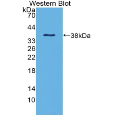 Defensin Beta 1 (DEFb1) Human Polyclonal Antibody