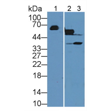 Gamma-Glutamyltransferase 1 (gGT1) Human Polyclonal Antibody