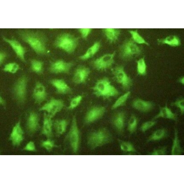 Gamma-Glutamyltransferase 1 (gGT1) Mouse Polyclonal Antibody