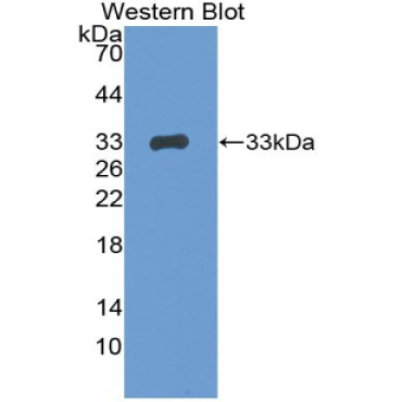 Breast Cancer Susceptibility Protein 1 (BRCA1) Mouse Polyclonal Antibody