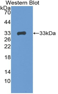 Breast Cancer Susceptibility Protein 1 (BRCA1) Mouse Polyclonal Antibody