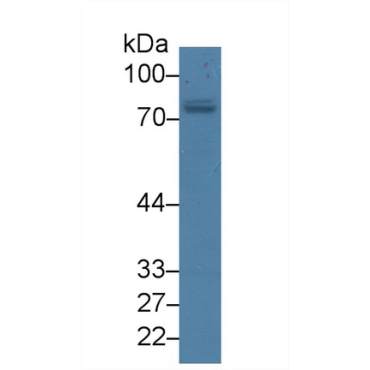 Protein Kinase C Zeta (PKCz) Human Polyclonal Antibody