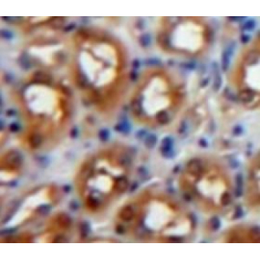 Protein Kinase C Zeta (PKCz) Mouse Polyclonal Antibody