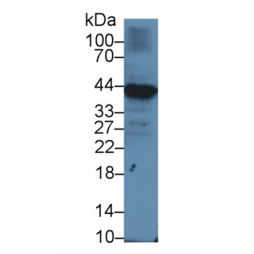 Immunoglobulin Associated Alpha (Iga) Human Polyclonal Antibody