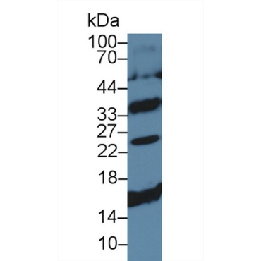 Cluster of Differentiation 79B (CD79B) Human Polyclonal Antibody