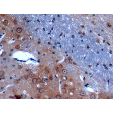 Anoctamin 1 (ANO1) Mouse Polyclonal Antibody
